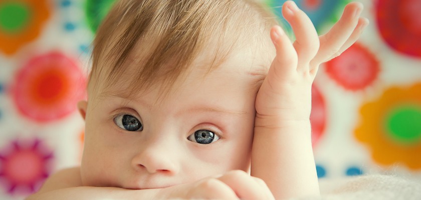 Dobrodo&scaron;lica za bebe sa Daunovim sindromom