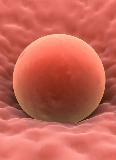 Postupak In Vitro Maturation (IVM)