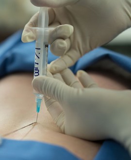 Epiduralna anestezija - da ili ne?
